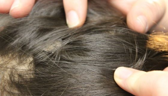 Why dont adults get head lice Amateur cumshot competition