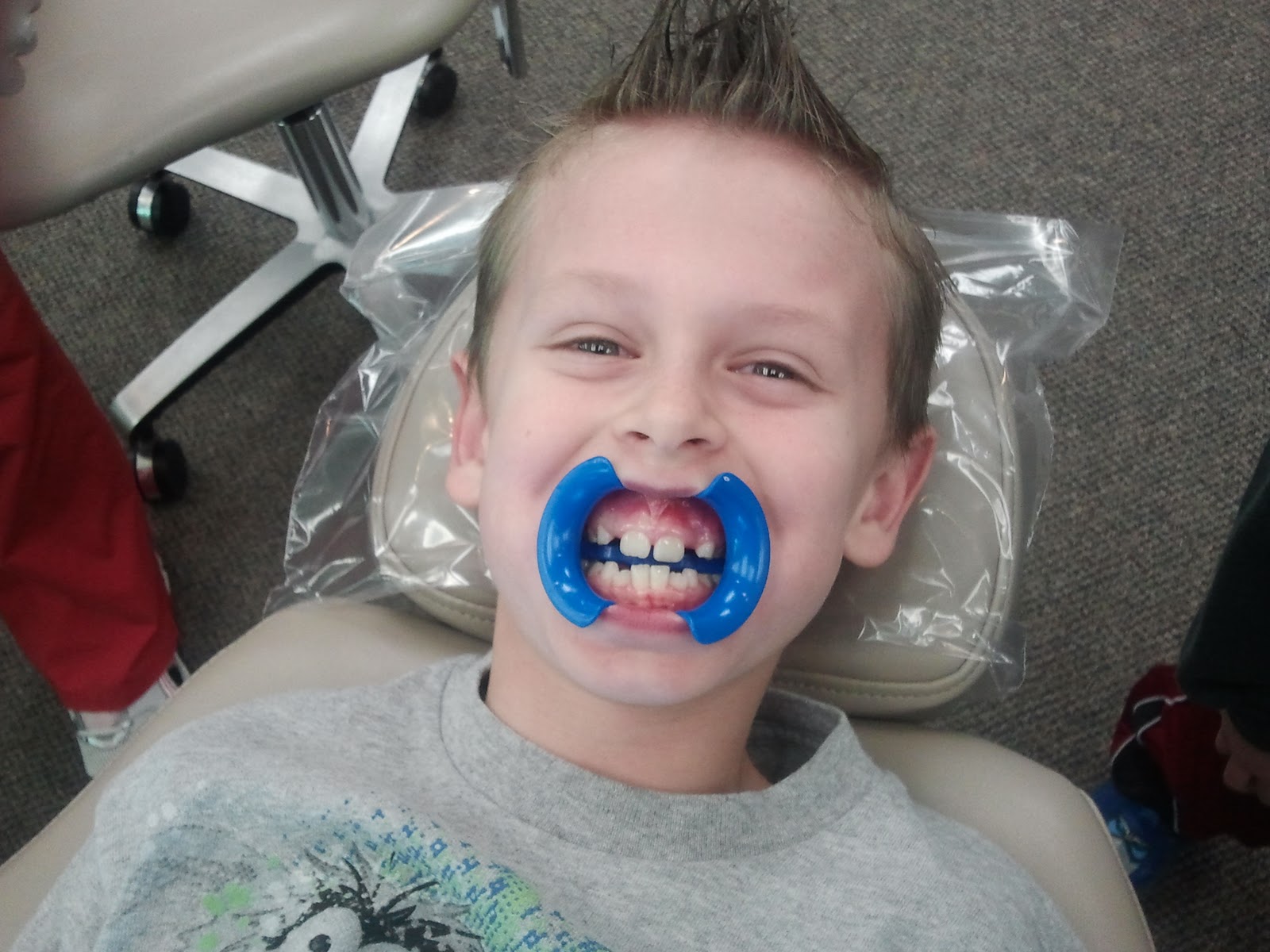 Getting Braces Off Quotes. QuotesGram