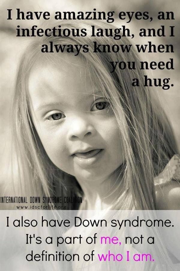 Down Syndrome Poems And Quotes. QuotesGram