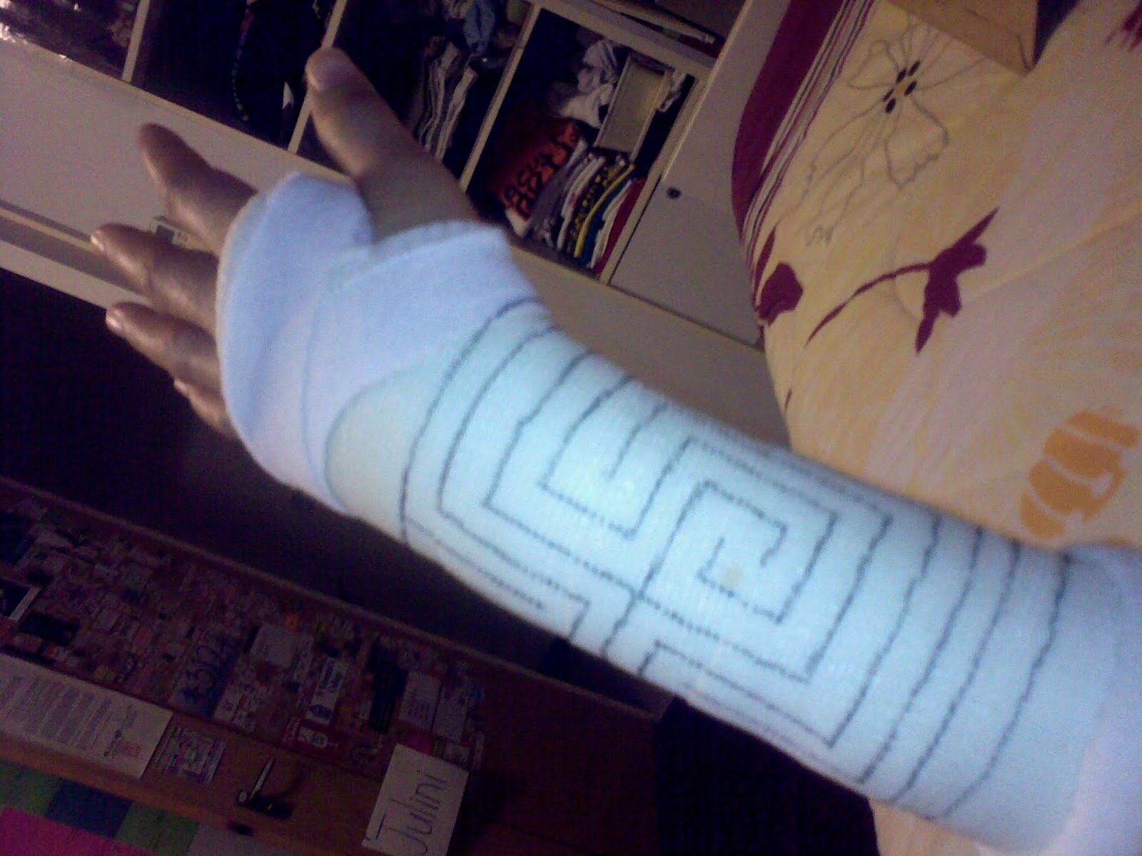 Arm Cast Quotes. QuotesGram