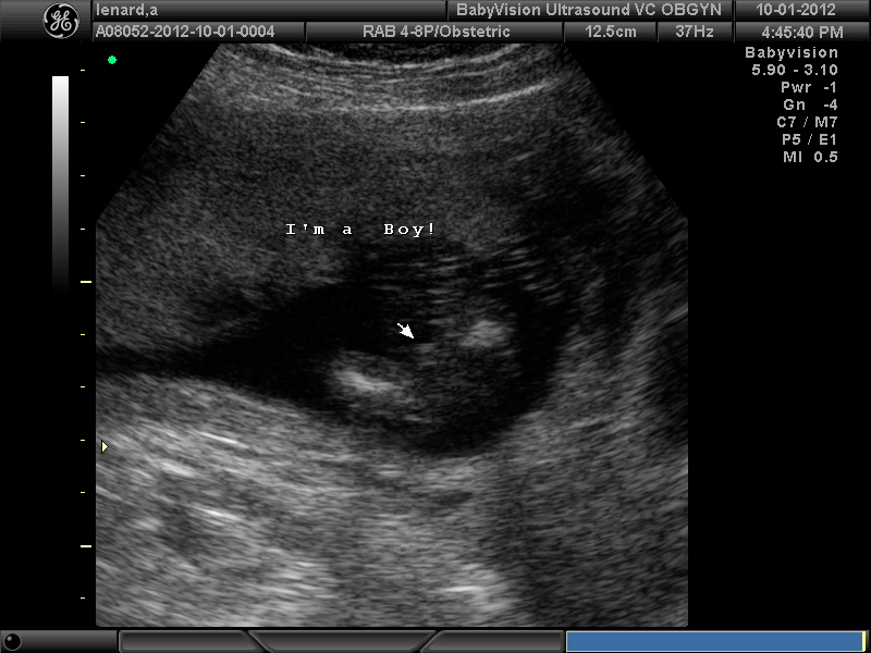 At baby weeks boy scan pictures 12 Boy or