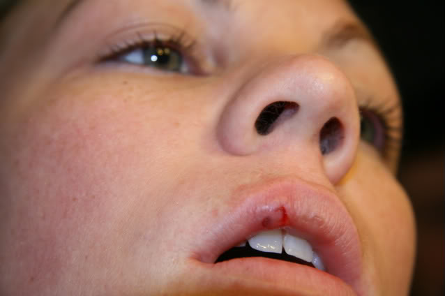 what does lip biting mean when kissing