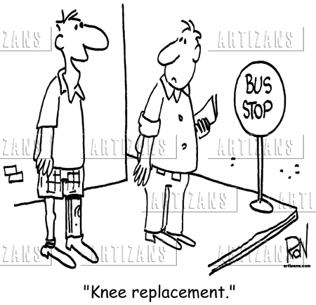 Knee Replacement Funny Quotes. QuotesGram