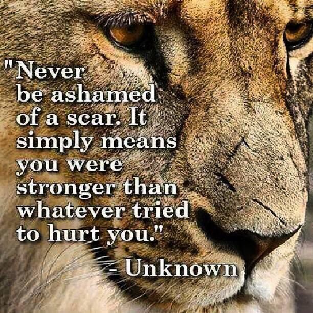 Scars Make Us Beautiful Quotes. QuotesGram