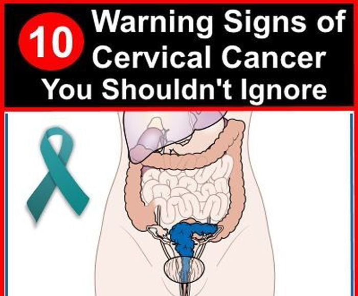 Of cervical signs cancer 10 Fighting cervical