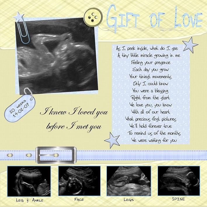 Ultrasound Cute Quotes. QuotesGram Ultrasound Cute Quotes. QuotesGram