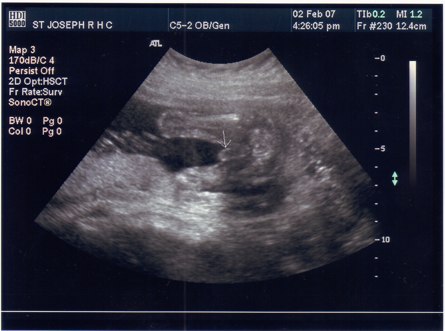 Quotes Its A Boy Ultrasound. QuotesGram