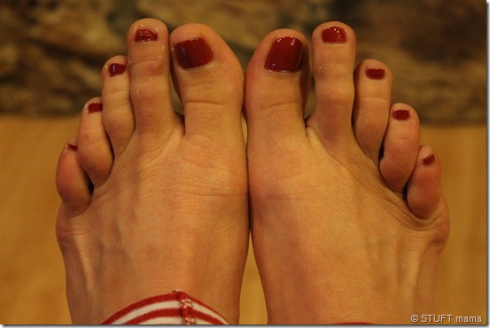 Skin toes light Google Answers: