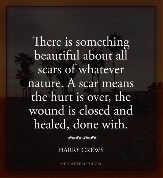 Scars Make Us Beautiful Quotes. QuotesGram