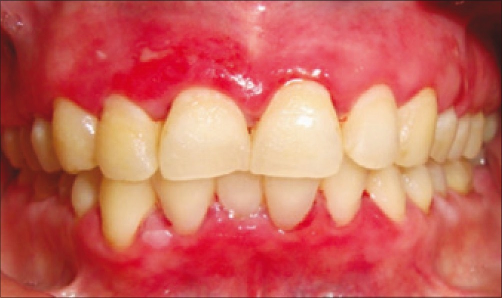 Gingervitis South Park Quotes. QuotesGram