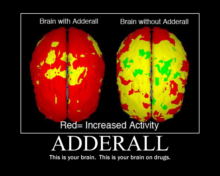Adderall Funny Quotes.