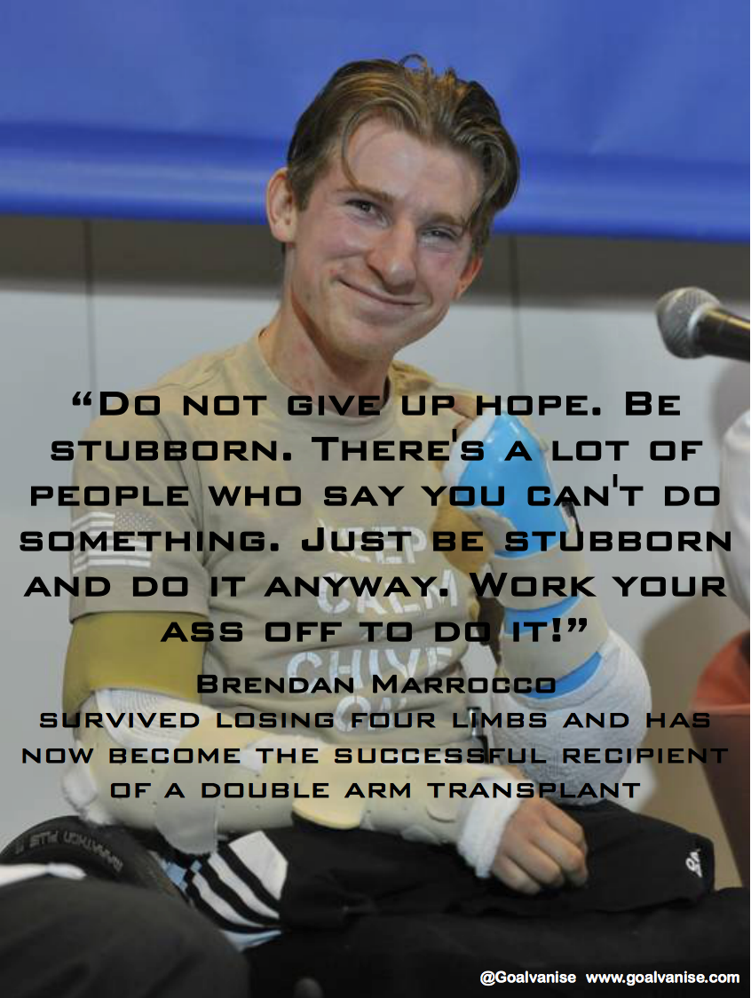 Inspirational Quotes About Amputees. QuotesGram
