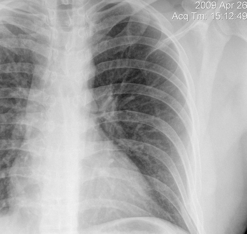 Rib Cracking Quotes. QuotesGram