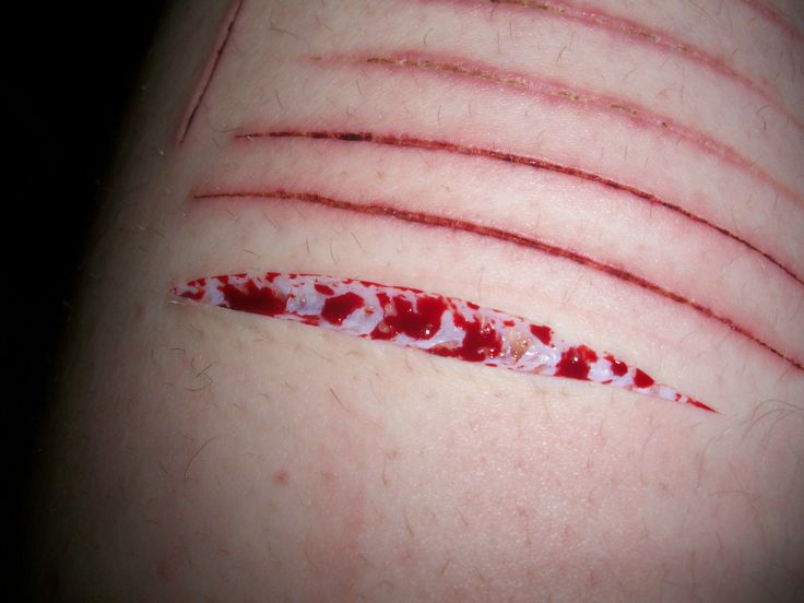 Deep Quotes About Cutting Scars. QuotesGram