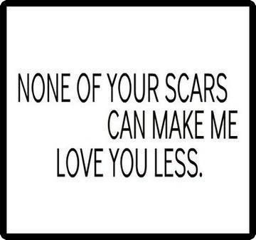 The Most Beautiful People Have Scars Quotes Quotesgram
