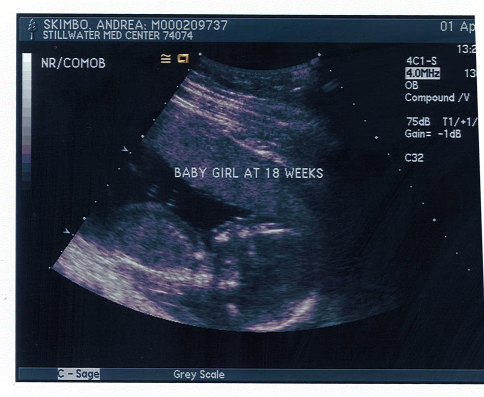 Ultrasound Funny Quotes. QuotesGram