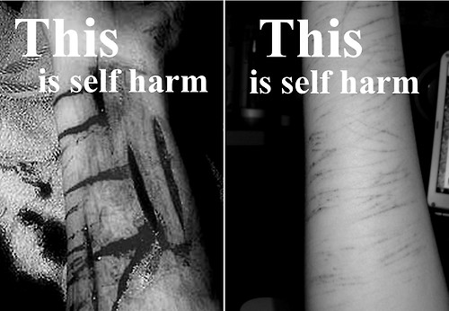 Quotes Of Self Harm Deep. QuotesGram