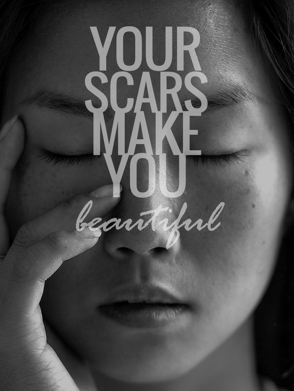 Scars Make Us Beautiful Quotes. QuotesGram