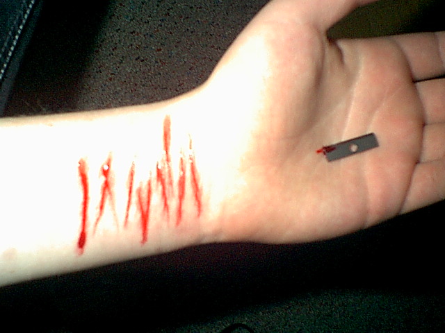 Emo Cuts On Wrist Quotes.
