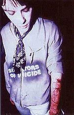 Edwards with 4 Real carved into his arm. The NME discussion as to ...