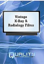 ... Ray Films: A Video History Of Medical Radiology & X-Ray Equipment