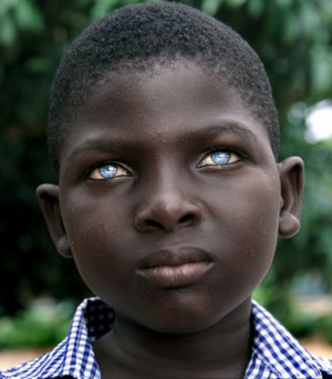 Blue eye African-American