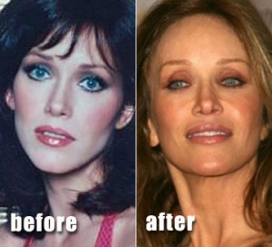 Related Plastic Surgery Articles!