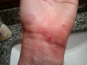 Cutting Wrists Quotes And my wrist bled like a stuck