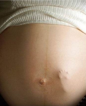 Science décalée : le sexe du bébé lu dans les seins des futures ...