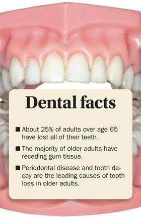 Periodontal disease and tooth decay is the leading causes of tooth ...