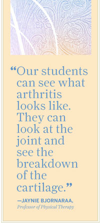 Our students can see what arthritis looks like. They can look at the ...