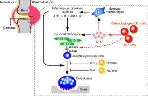 Interleukin 1 As A Strategy For The Treatment Of Rheumatoid Arthritis