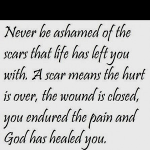 Scars mean your healing :)