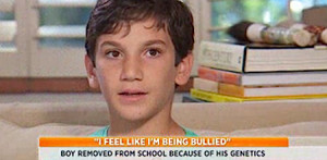 Boy Banned From School For Bad Genes