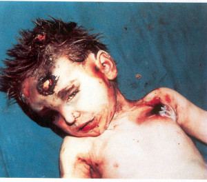 Albanians Weren’t the First to Steal Serb Organs (Warning: Graphic ...