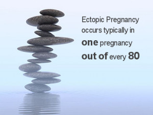 Ectopic Pregnancy Statistics 2013