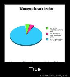 Haha- 90% of my bruises are from basketball, 5% me failing epically at ...