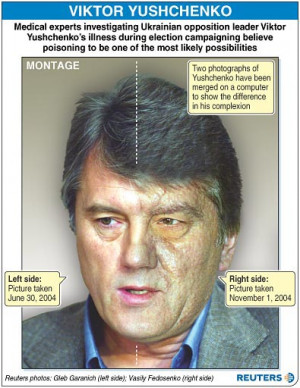 Chloracne Viktor Yushchenko Chloracne for many years,