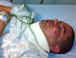 Larry Hernandez Injured Car