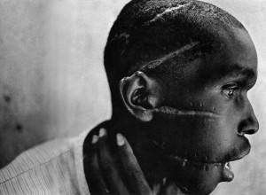 Rwandan boy left scarred after being liberated from a death camp.