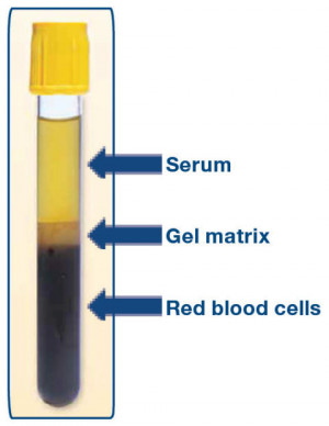 Serum Separator Blood Tube