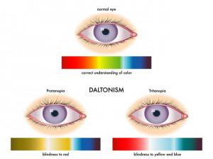 Color Blindness Symptoms