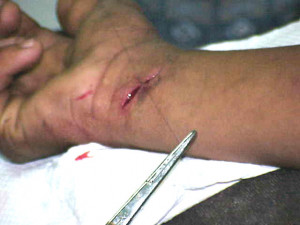 Displaying Gallery Images...