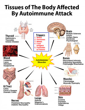 ... in triggering autoimmune illness as depicted in the diagram below