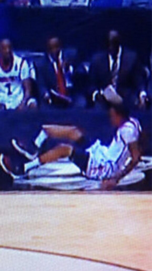 Kevin Ware Broken Leg Picture