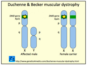 DMD Duchenne Muscular Dystrophy Chromosome