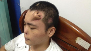 Bei einem Verkehrsunfall verletzte sich ein junger Mann aus China an ...