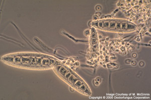 Ringworm Spores Under Microscope