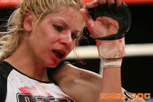 female mma fighter teeth busted up even with mouthguard