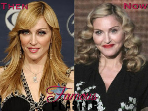 Famous Plastic - Celebrity Plastic Surgery Pictures and Celebrity C...